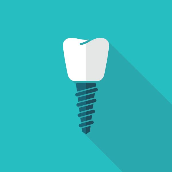 Advantages Of Getting Dental Implants